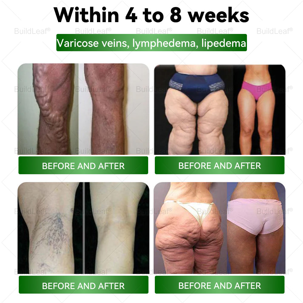 HHVB® GLP-1 Gouttes Minceur à la Moringa ✅ Brûleur de graisse 100 % naturel, développé par des experts en perte de poids. Pour une silhouette affinée et une santé renforcée.