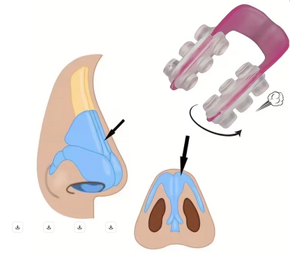 NoseLift™ – Clip Rehausseur de Nez Sans Chirurgie(💥 Offre 1+1 Gratuit.💥)