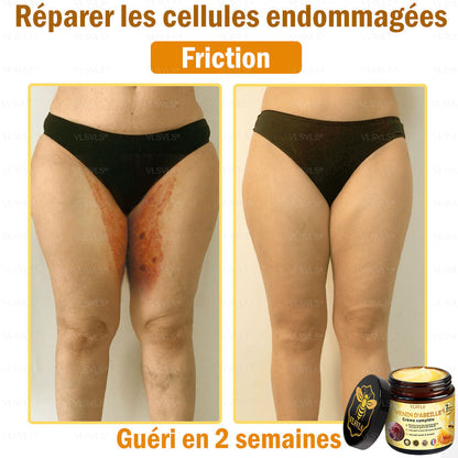 Venin d'abeille Crème de traitement de l'arthrite au venin d'abeille