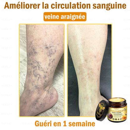 Venin d'abeille Crème de traitement de l'arthrite au venin d'abeille