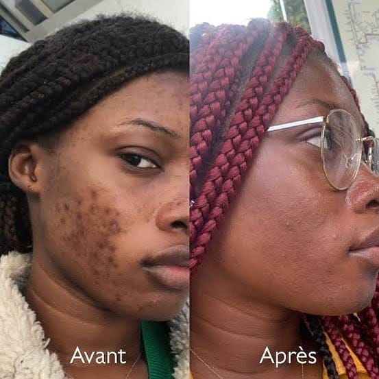 Savon anti - taches