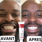 Dentifrice Blanchissant Probiotique SP4 – Sourire Blanc & Haleine Fraîche