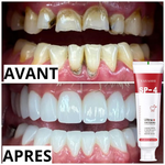 Dentifrice Blanchissant Probiotique SP4 – Sourire Blanc & Haleine Fraîche