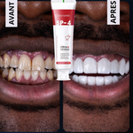 Dentifrice Blanchissant Probiotique SP4 – Sourire Blanc & Haleine Fraîche