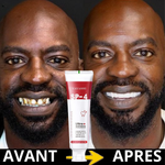 Dentifrice Blanchissant Probiotique SP4 – Sourire Blanc & Haleine Fraîche