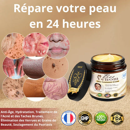 Crème au Venin d'Abeille | Répare votre peau en 72 heures!  Crème au Venin d'Abeille.