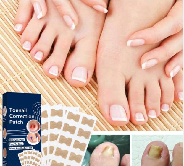 Correcteur d'ongles pour lutter conte les ongles infectés(1 paquet acheté = 1 paquet offert (1 paquet contient 50pièces)