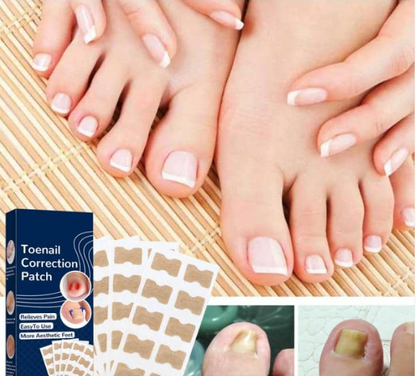 Correcteur d'ongles pour lutter conte les ongles infectés(1 paquet acheté = 1 paquet offert (1 paquet contient 50pièces)