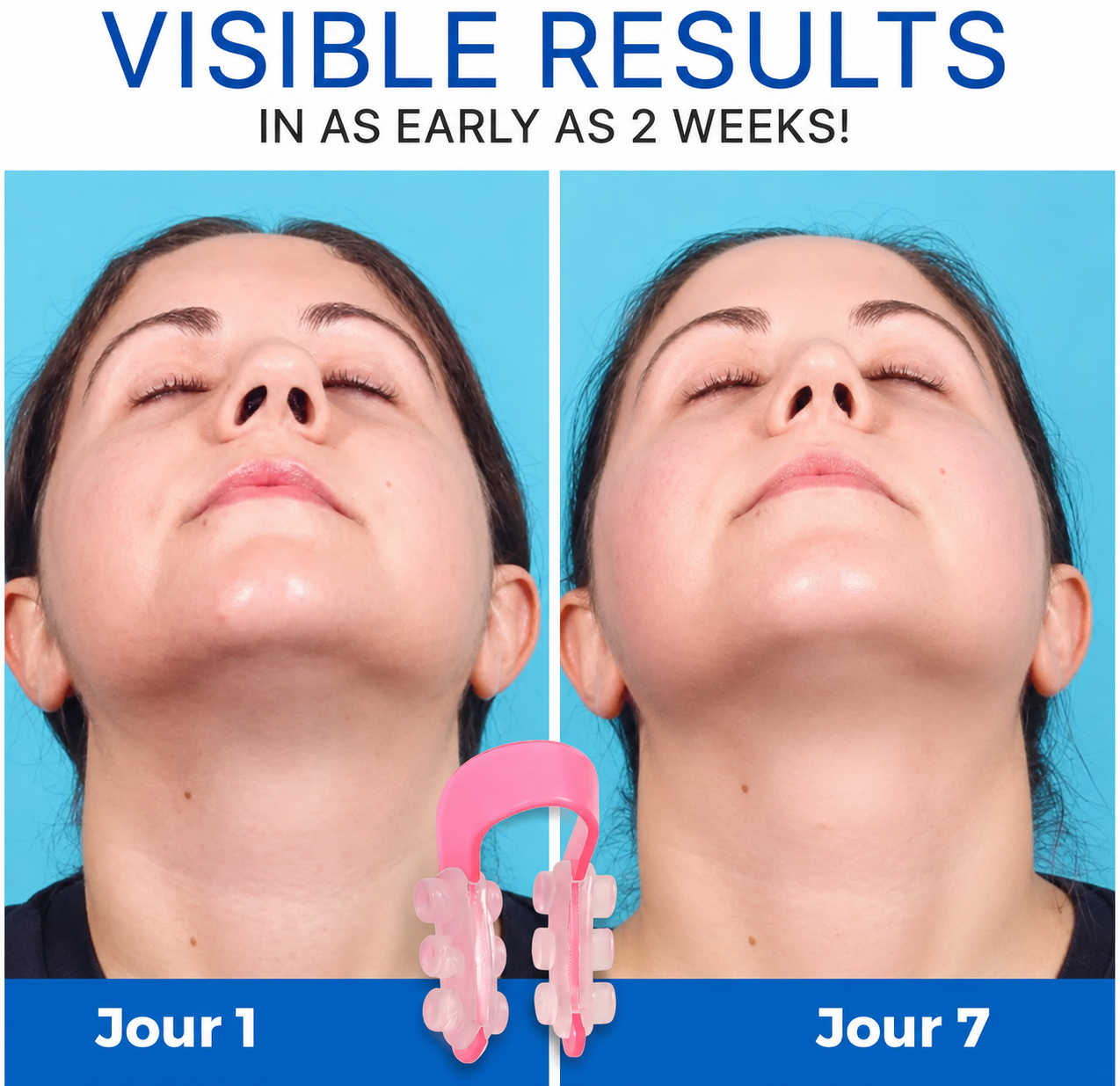 NoseLift Pro — Correcteur de Nez Sans Chirurgie | Résultat Visible en 30 jours(Achetez 1 obtenez 1 gratuit)