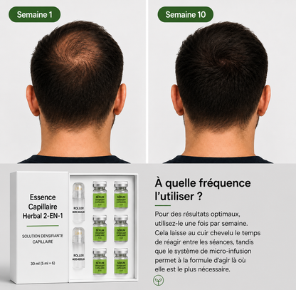 Système de soutien à la croissance des cheveux – Kit de soins du cuir chevelu pour des cheveux plus épais et plus fournis