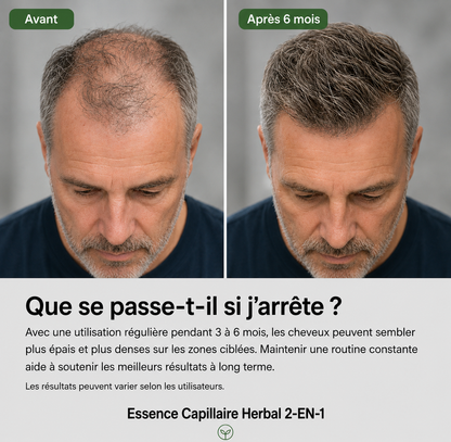 Système de soutien à la croissance des cheveux – Kit de soins du cuir chevelu pour des cheveux plus épais et plus fournis