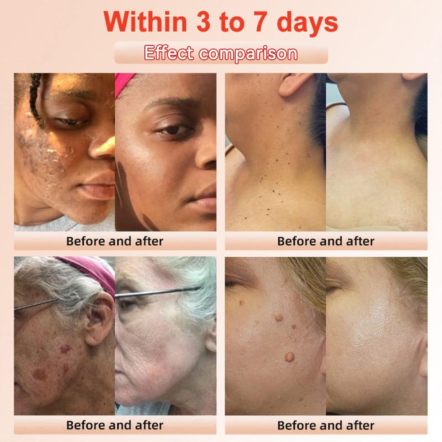 Gel Exfoliant Purifiant