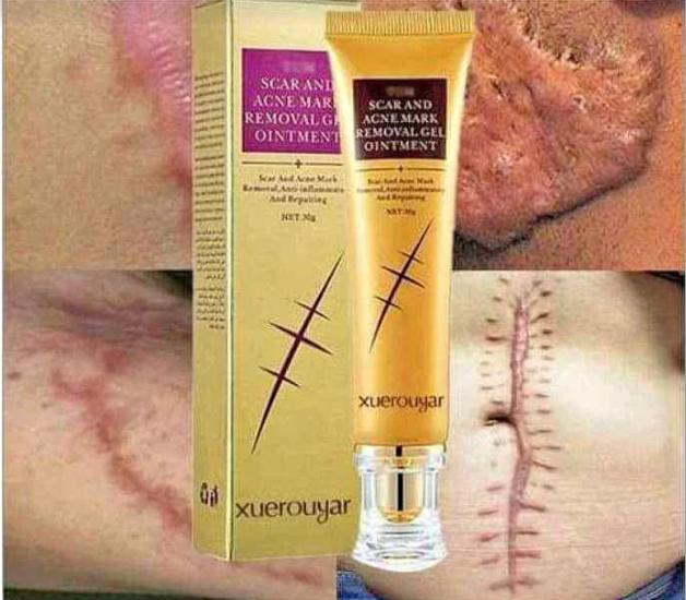 Crème Anti Cicatrice