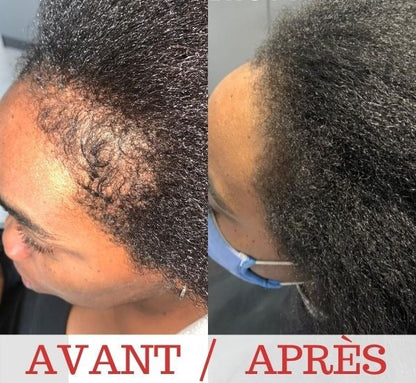 Huile essentielle pousse cheveux