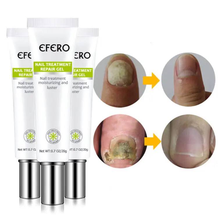 EFFERO NAILS™-Soin Complet: Pousse,Durcit et Traite les ongles.