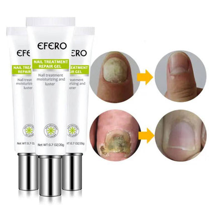 EFFERO NAILS™-Soin Complet: Pousse,Durcit et Traite les ongles.