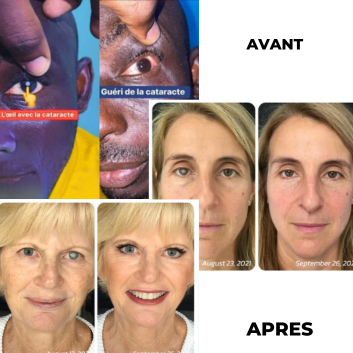 OphthlaMed™ – Le Secret d'une Vision Claire ET Recommandées par les Médecins
