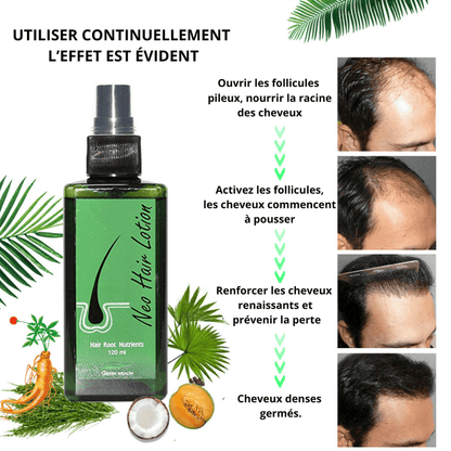 Dites adieu aux cheveux clairsemés