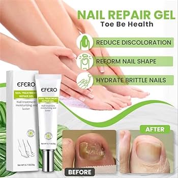EFFERO NAILS™-Soin Complet: Pousse,Durcit et Traite les ongles.