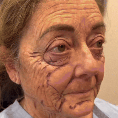 Venin d'abeille Crème de traitement de l'arthrite au venin d'abeille