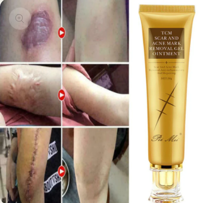 Crème Anti Cicatrice