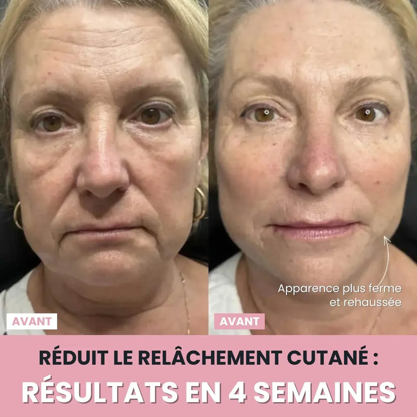 Sculpteur Facial LED 7-en-1 Anti-Âge – Les signes de l’âge ne préviennent pas… mais vous pouvez agir