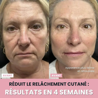 Sculpteur Facial LED 7-en-1 Anti-Âge – Les signes de l’âge ne préviennent pas… mais vous pouvez agir