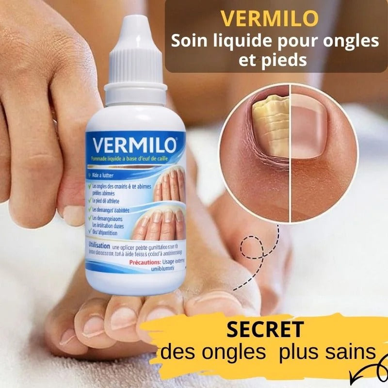 DITES ADIEU AUX ONGLES ABÎMÉS, AUX MYCOSES ET AU PIED D’ATHLÈTE EN SEULEMENT 7 JOURS!