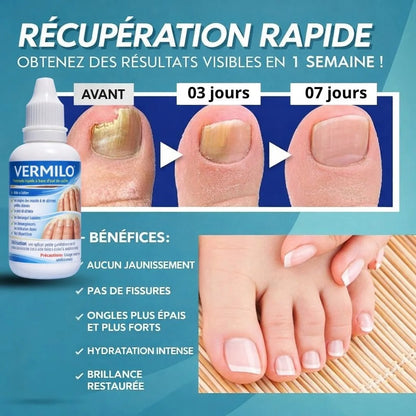 DITES ADIEU AUX ONGLES ABÎMÉS, AUX MYCOSES ET AU PIED D’ATHLÈTE EN SEULEMENT 7 JOURS!
