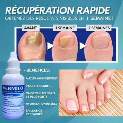 DITES ADIEU AUX ONGLES ABÎMÉS, AUX MYCOSES ET AU PIED D’ATHLÈTE EN SEULEMENT 7 JOURS!