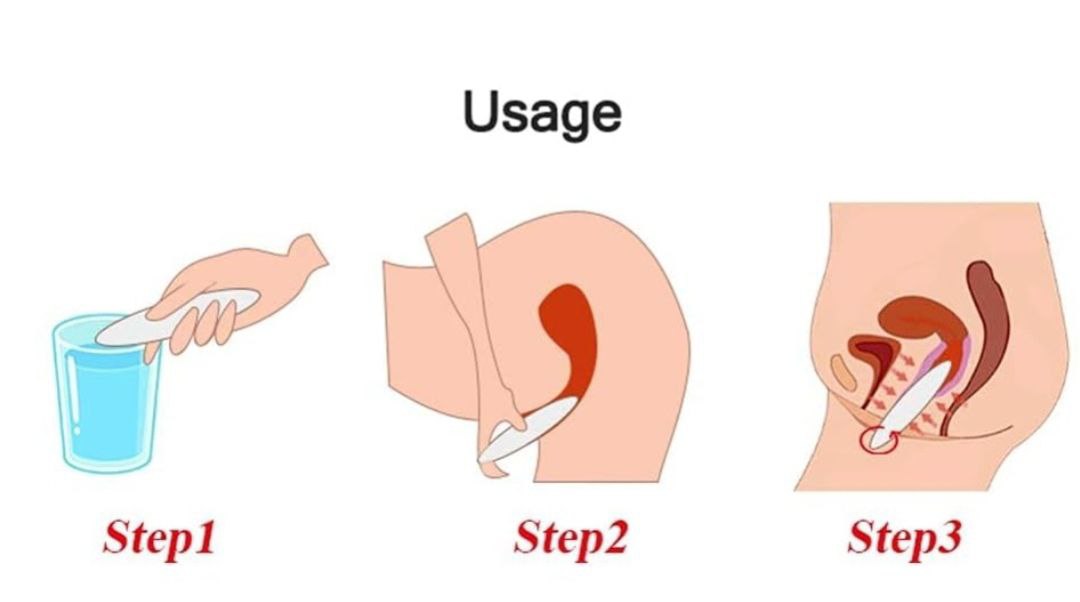 Resserrez votre GESSICA en seulement 60 secondes, réutilisable jusqu'à 40 fois !