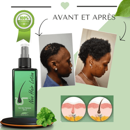 Dites adieu aux cheveux clairsemés